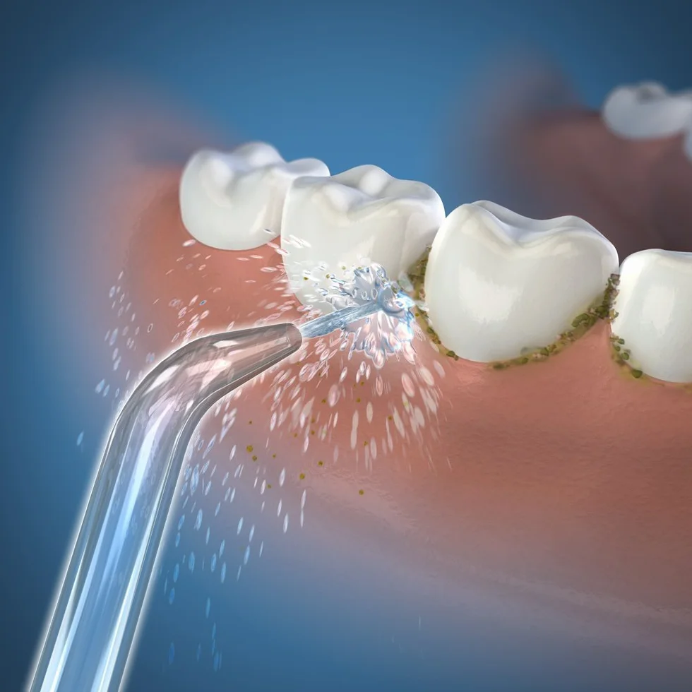 Waterpik Klasyczne końcówki Jet JT-100E 2 Końcówki