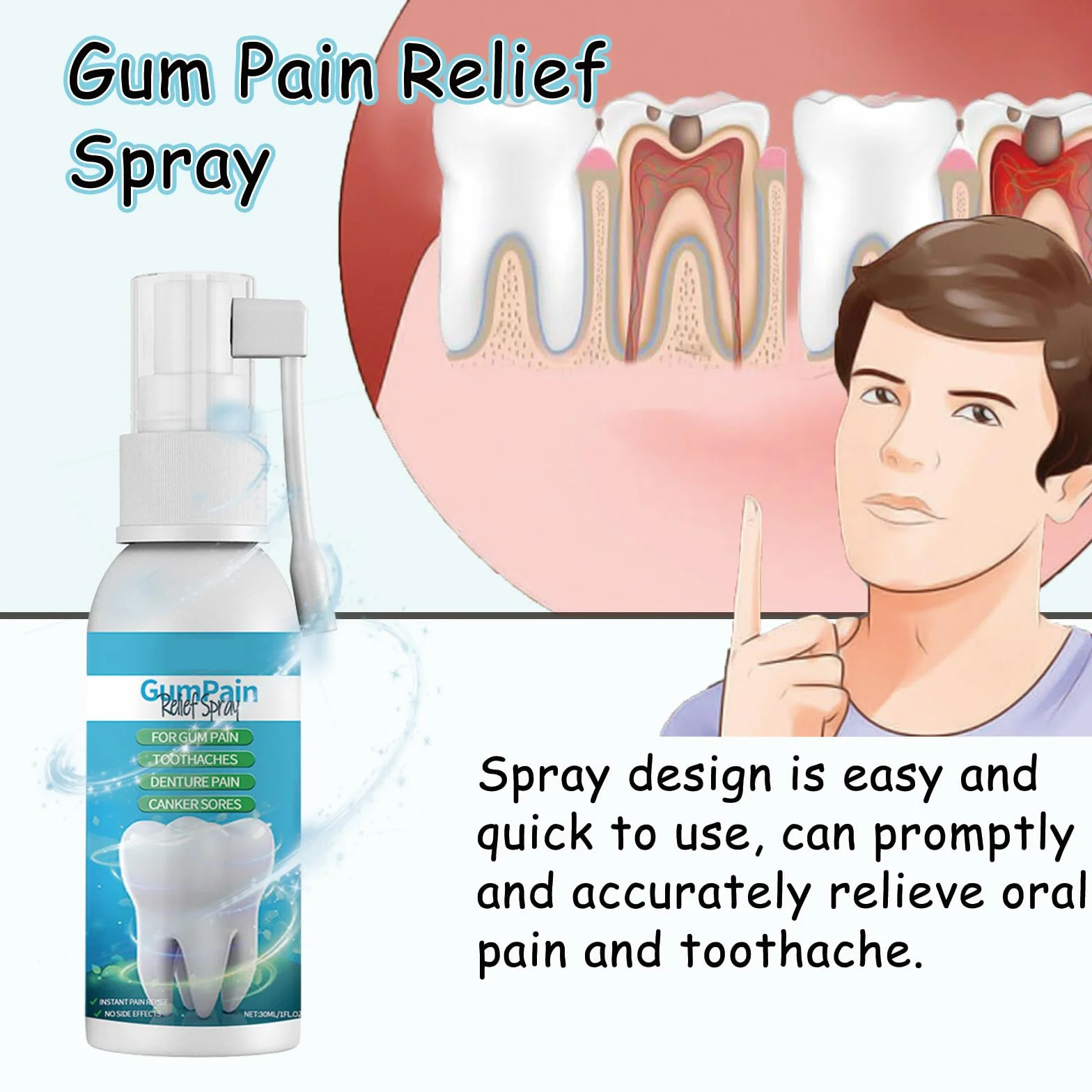 Spraye do naprawy dziąseł, gumki do zębów Spray do bólu zębów, przenośny spray do pielęgnacji jamy ustnej, ziołowy spray do pielęgnacji jamy ustnej, 30ml