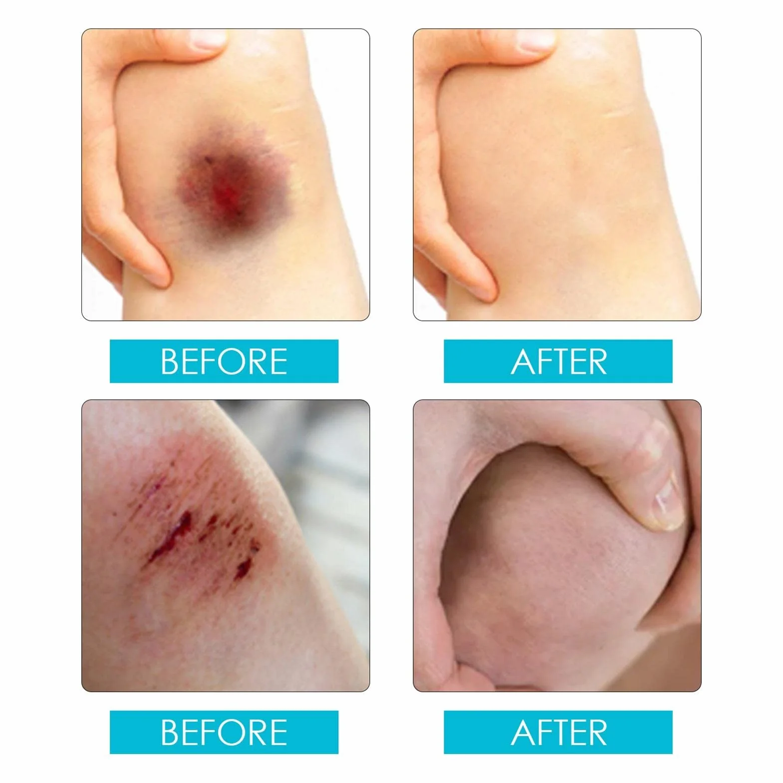 Liquid Bandage Spray 30ml Waterproof Breathable Quick-Dry Transparent Wound Protective Film