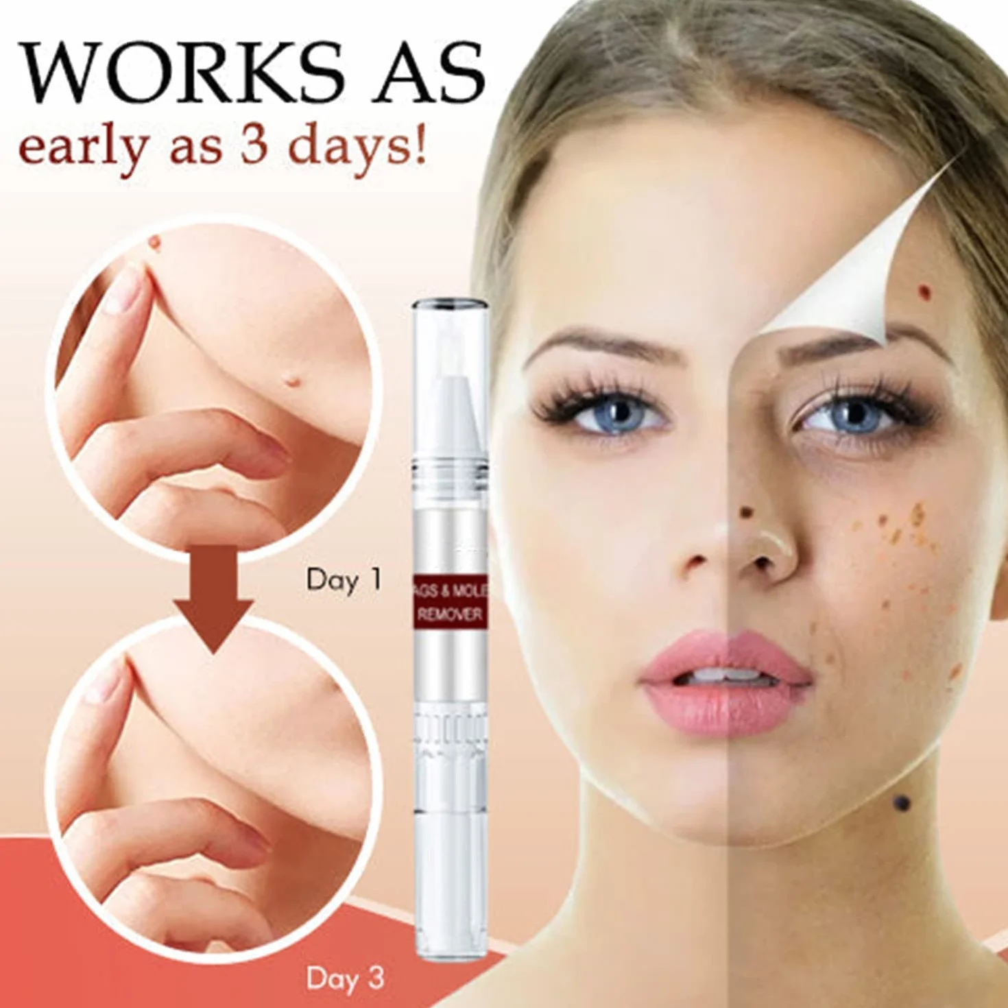 Skin Tag Remover & Mole Remover Wipeoff Tags, 3 Pcs, Quick Safe Remove