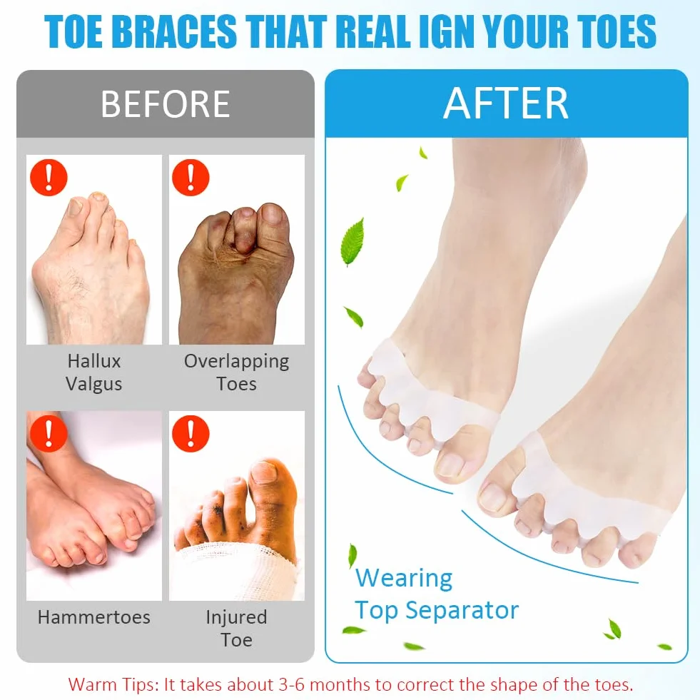 ACWOO Korektor palców Bunion, miękkie żelowe ochraniacze na kolano, dla dużych palców, odprężające, rozkładane, do Hallux Valgus & Bunion Support (4 pary)