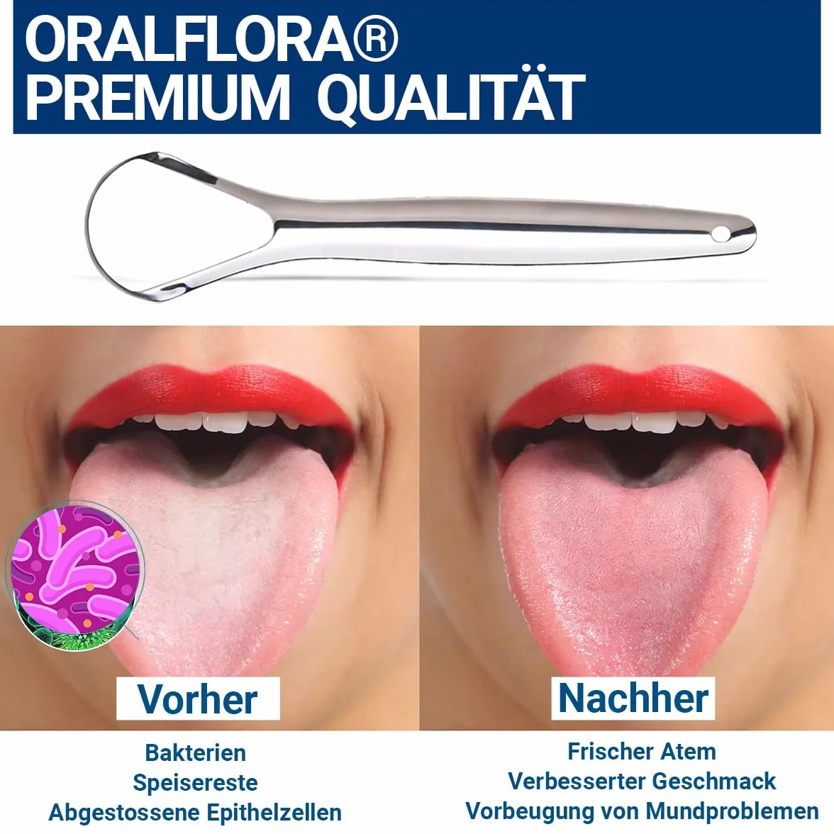 2 x zestaw skrobaków do języka ze 100% chirurgicznej stali nierdzewnej, środek do czyszczenia języka dla dorosłych i dzieci, redukuje nieświeży oddech, poprawia higienę jamy ustnej – ze znakiem