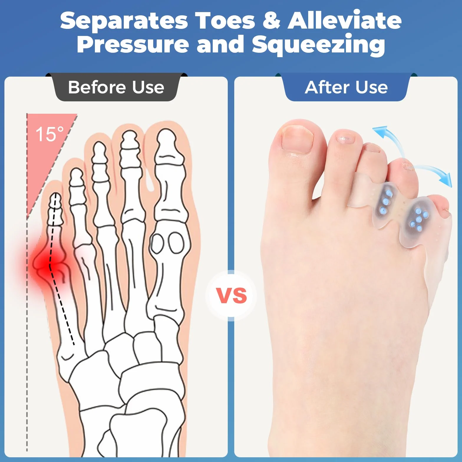 Tailors Korektor haluksów i Pinky Toe Protector – prostownice do palców, separatory, łagodzenie bólu