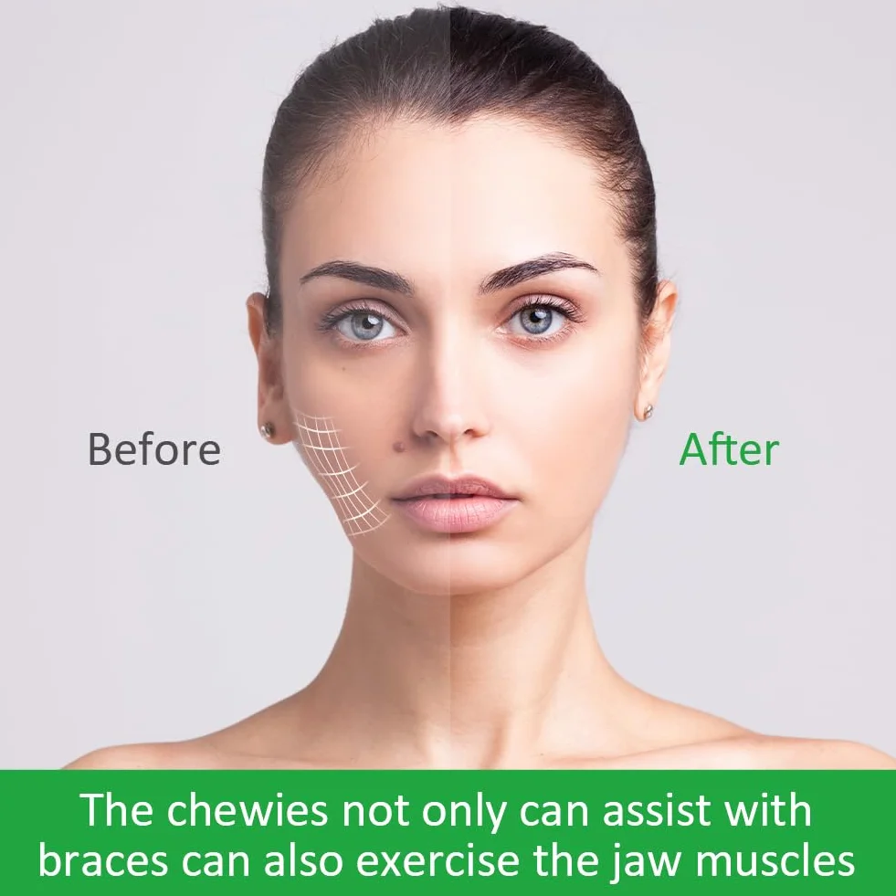 OFFCUP Aligner Chewies, 10 sztuk Seater Aligner, taca Chewies, tacki wyrównujące, wyrównanie, seater w 5 kolorach (żółty fioletowy zielony czerwony pomarańczowy)