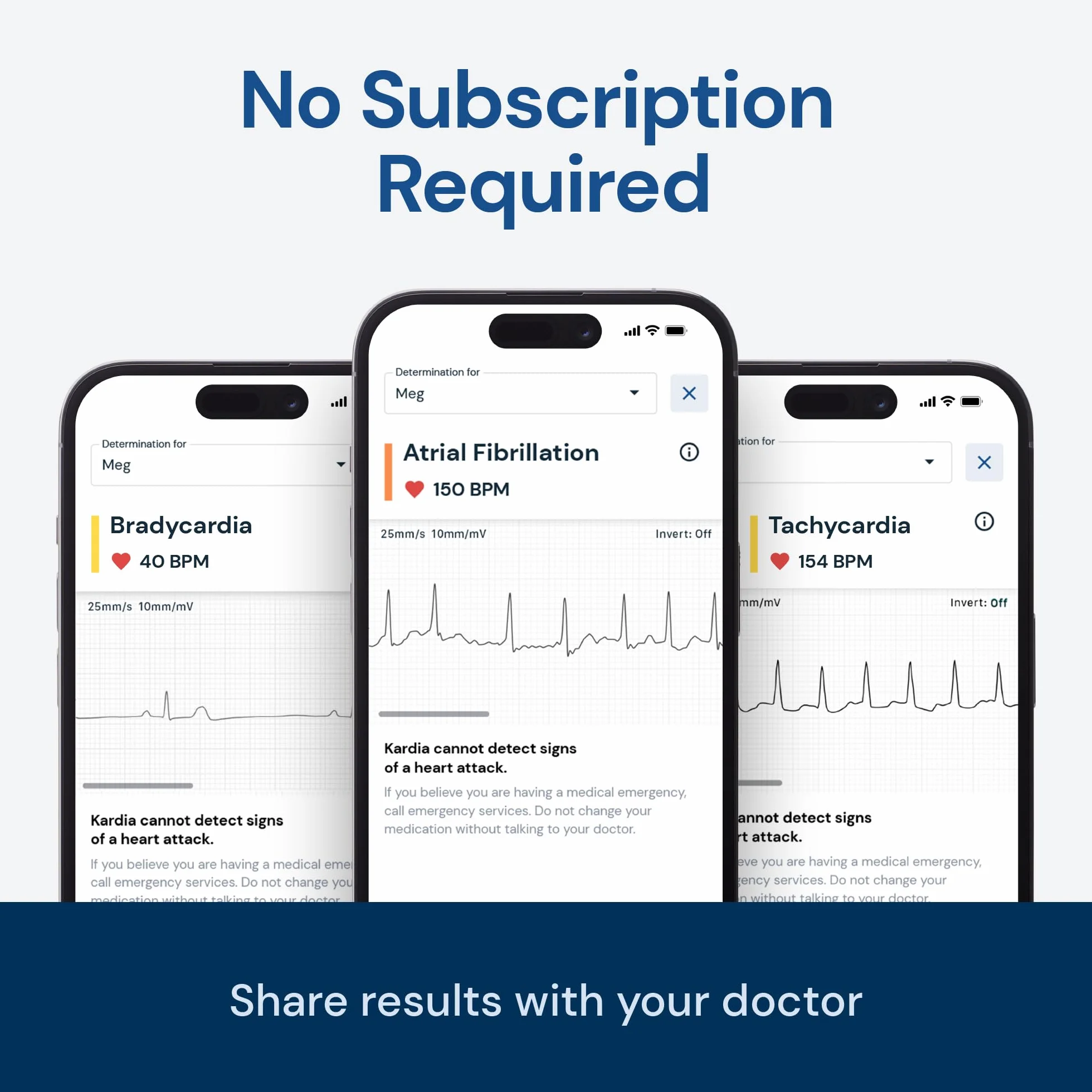 KardiaMobile osobisty jednoprzewodowy monitor EKG - wykrywa migotanie przedsionków i inne arytmie - wyniki w 30 sekund - łatwy w użyciu - współpracuje z większością smartfonów