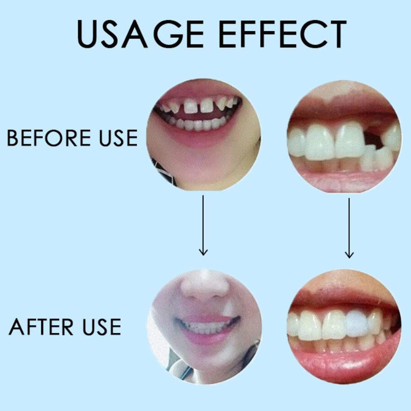 Dentystyczne koraliki termiczne licówki zębów formowalne proteza tymczasowa naprawa zębów 25 g