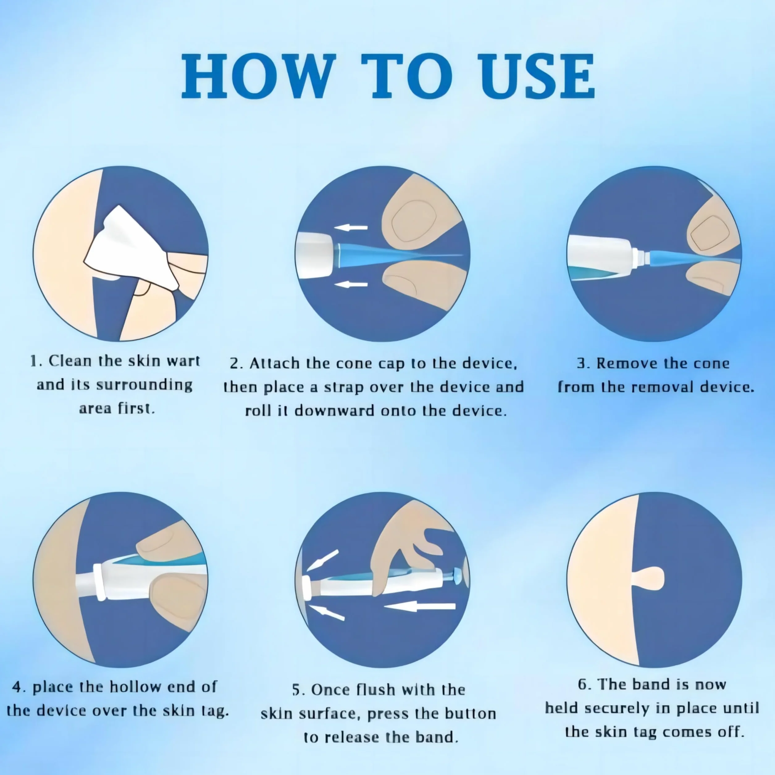 Auto Skin Tag Remover zestaw do usuwania brodawek 3 w 1 (1-8 mm)