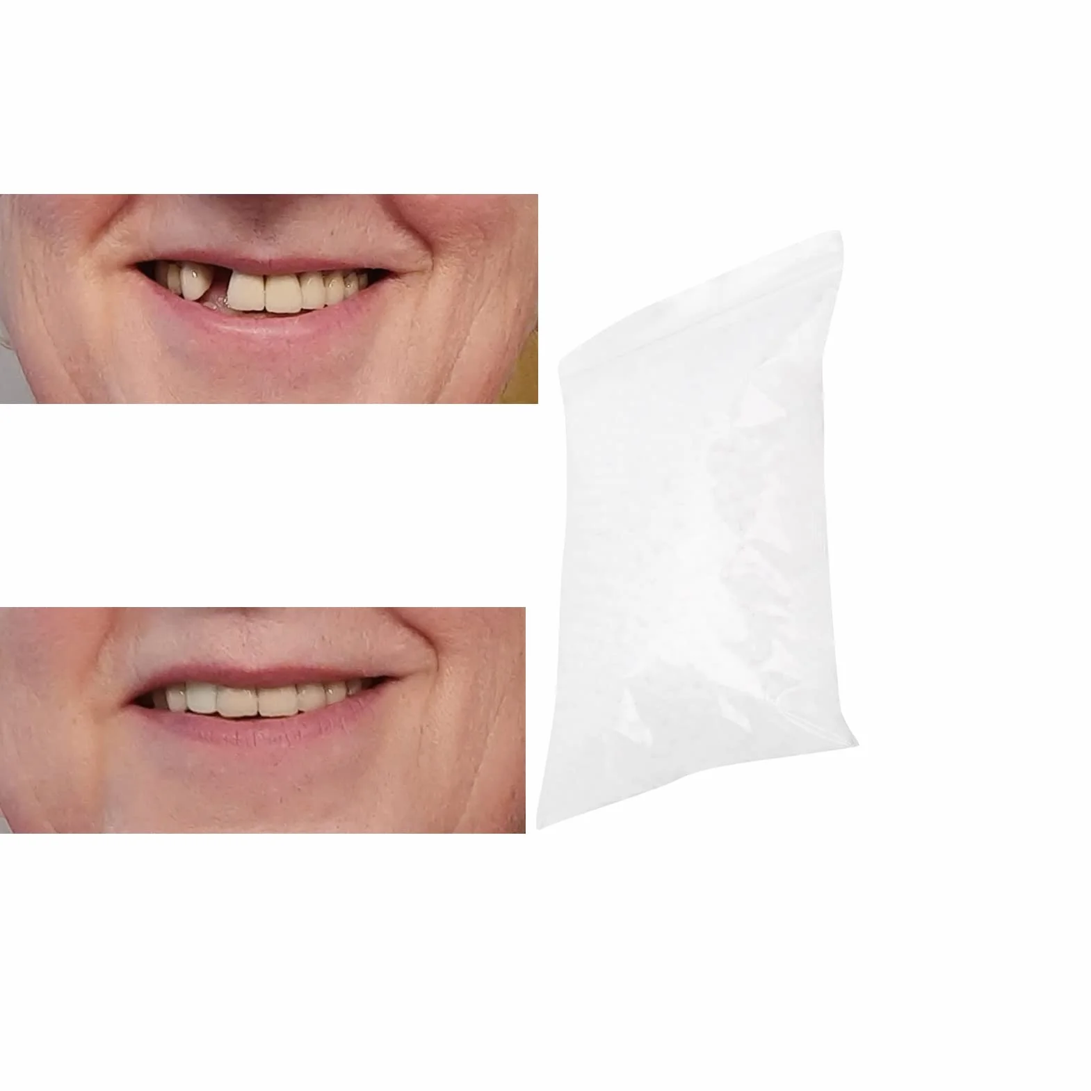 Zęby fornirowane Clip In, tymczasowe koraliki do naprawy zębów, materiał wypełniający zęby, cement dentystyczny (100 g)