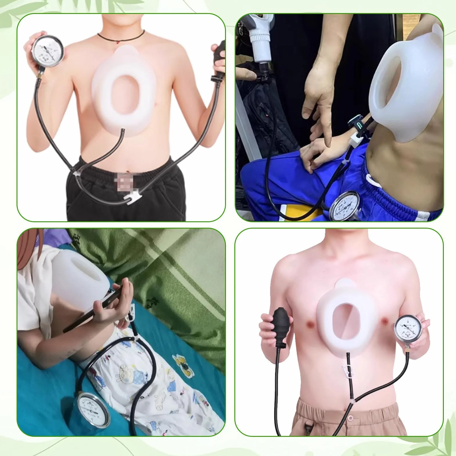 Pectus Excavatum Vacuum Bell, Orteza Na Klatkę Piersiową Dla GołęBi, UrząDzenie Korekcyjne Z Manometrem, Terapia Dzwonem PróżNiowym Standard-S