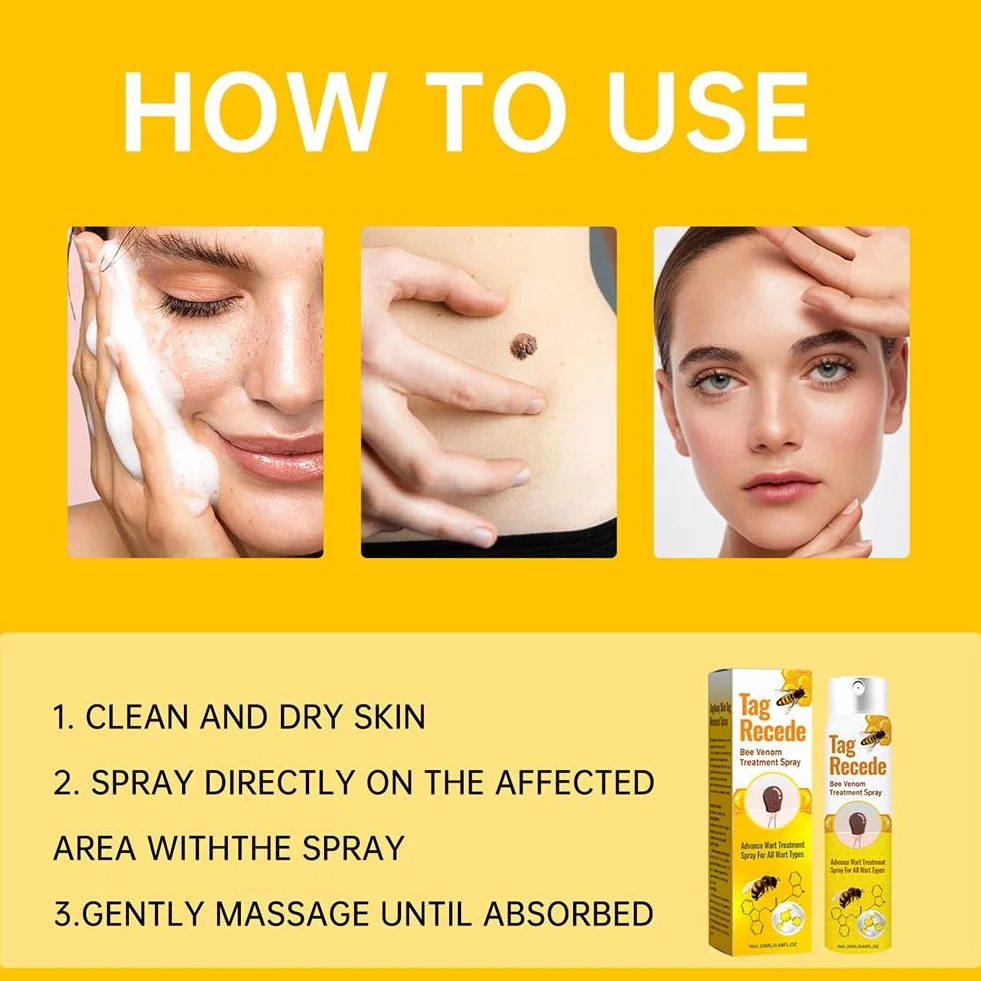 Bezbolesny spray do usuwania brodawek z pszczelim 20 ml 2 szt