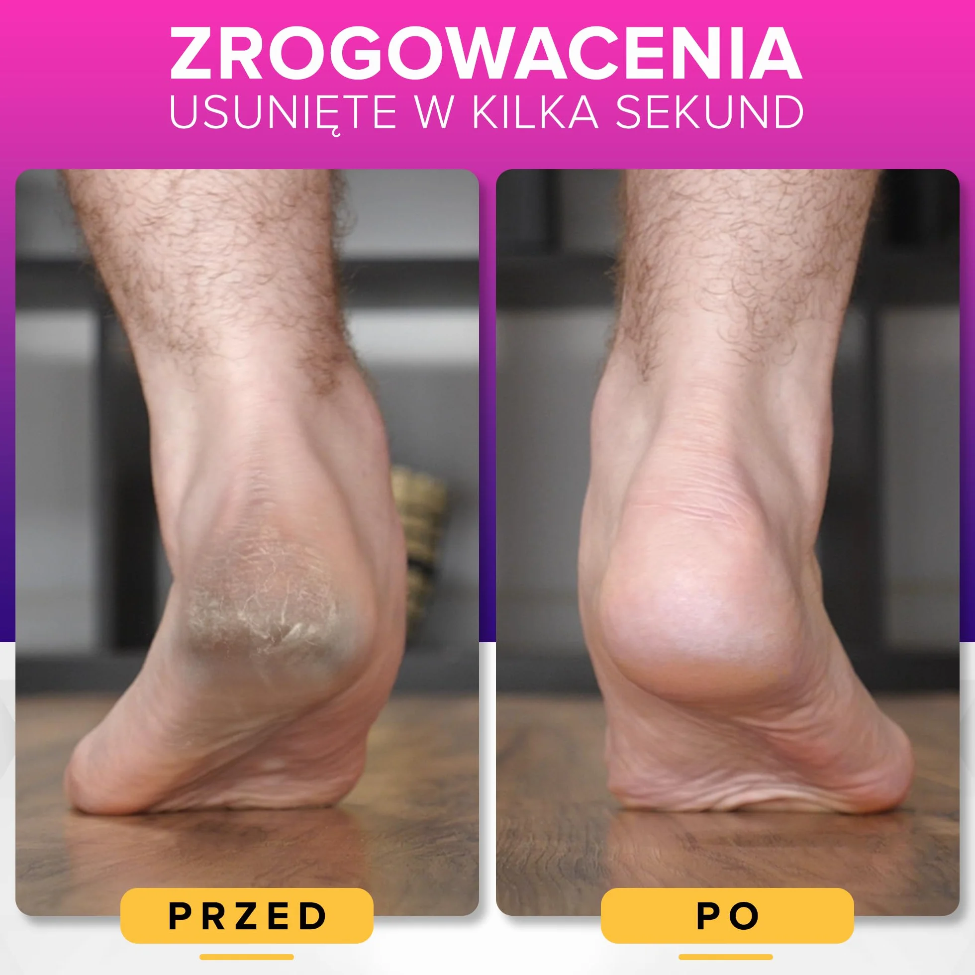 NYK1 MEGAFILE Pilniki Do Stóp Pedicure Skrobaczka Do Stóp Rozmiar XL