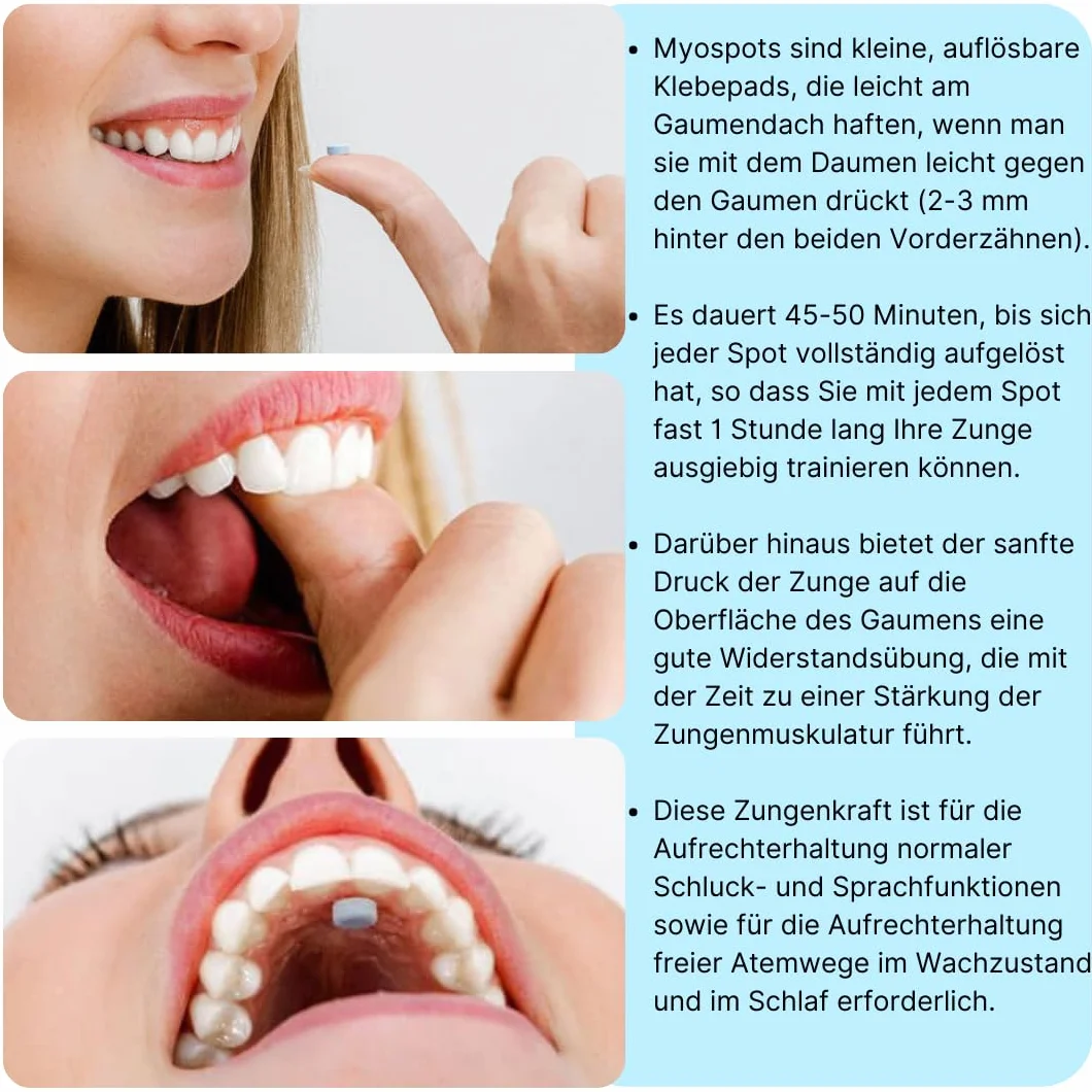 Myospots 100 tabletek ćwiczenia dla pozycji spoczynkowej języka mix smaków