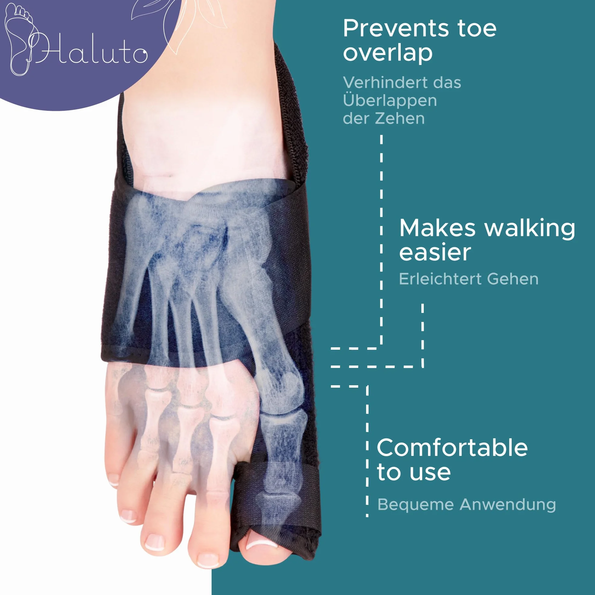 HALUTO - Szyna na haluksy - Skuteczna szyna na haluksy łagodząca ból i wspomagająca korekcję palucha koślawego - Hallux Valgus Correction Splint