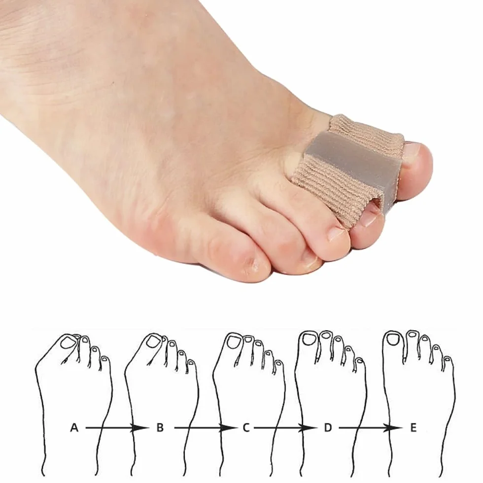 Bunions Corrector Big Toe Stretcher Straightener Hammer Toe Separator Gel Spreader 2 pary L