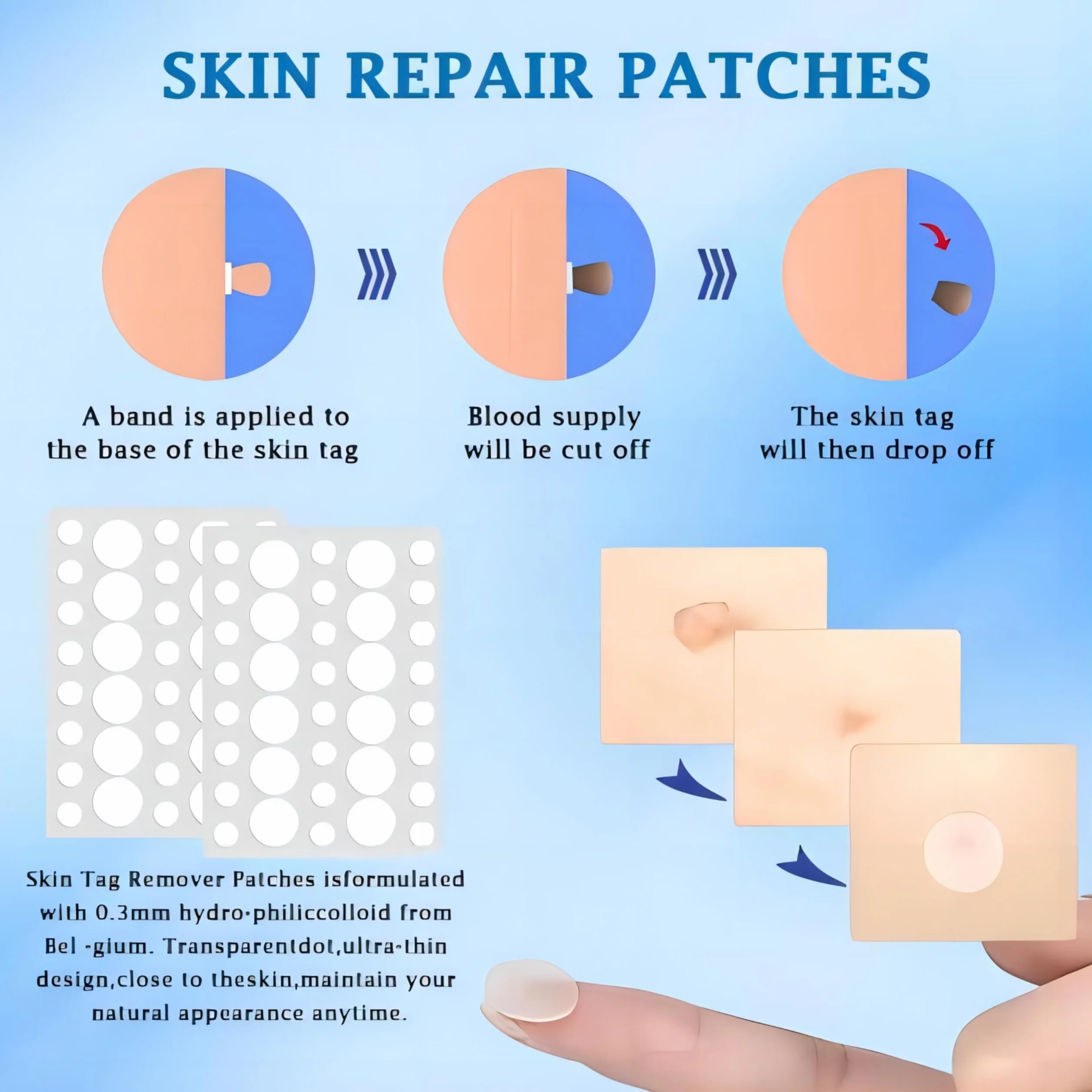 Auto Skin Tag Remover zestaw do usuwania brodawek 3 w 1 (1-8 mm)