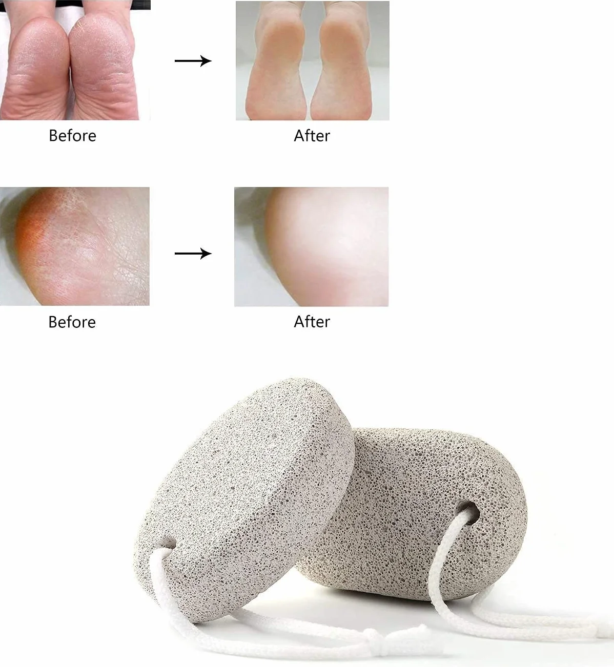 PHOGARY naturalny kamień pumeksowy do pielęgnacji stóp, 2 sztuki, do usuwania zrogowaciałej skóry, do stóp i dłoni. Naturalny peeling do stóp do usuwania martwej skóry.