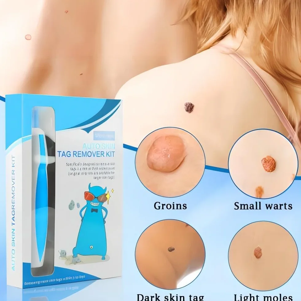 Auto Skin Tag Remover zestaw do usuwania brodawek 3 w 1 (1-8 mm)