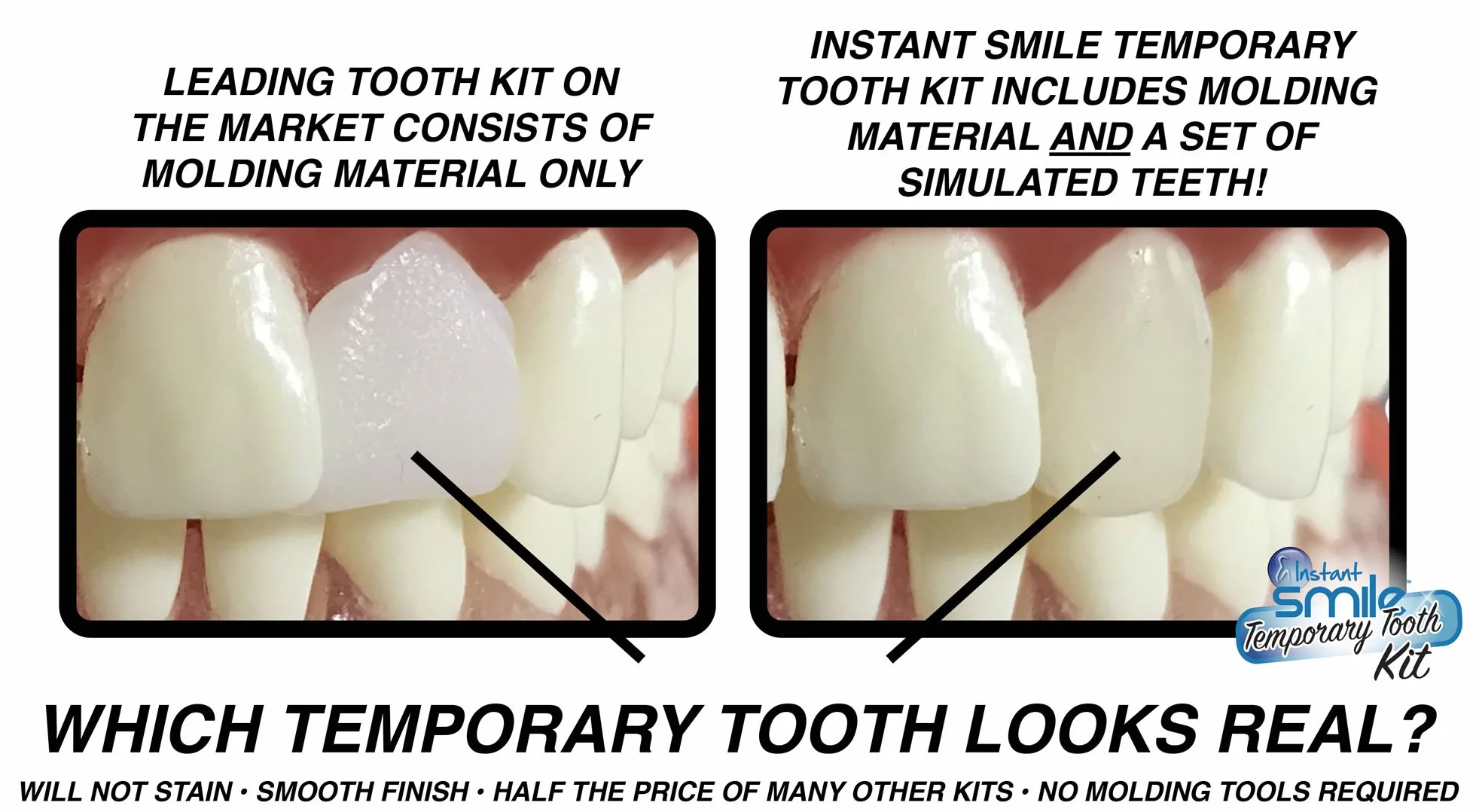 Opatentowany tymczasowy zestaw do naprawy zębów Instant Smile Multishade, wymień brakujący ząb w kilka minut