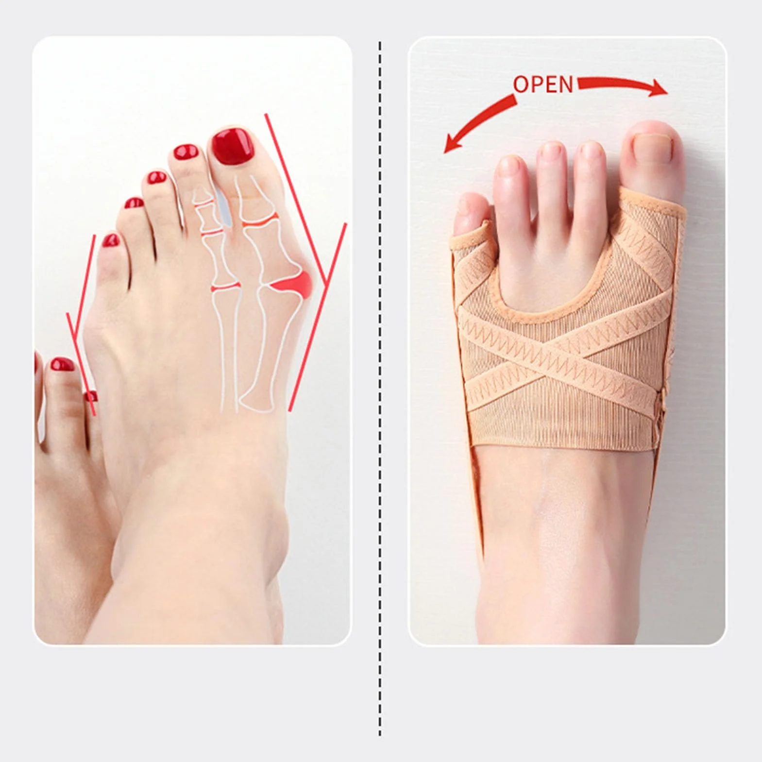 Skarpetki Korektorowe Bunion 2PCS Miękki Oddychający Separator Szyny dla Hallux Valgus