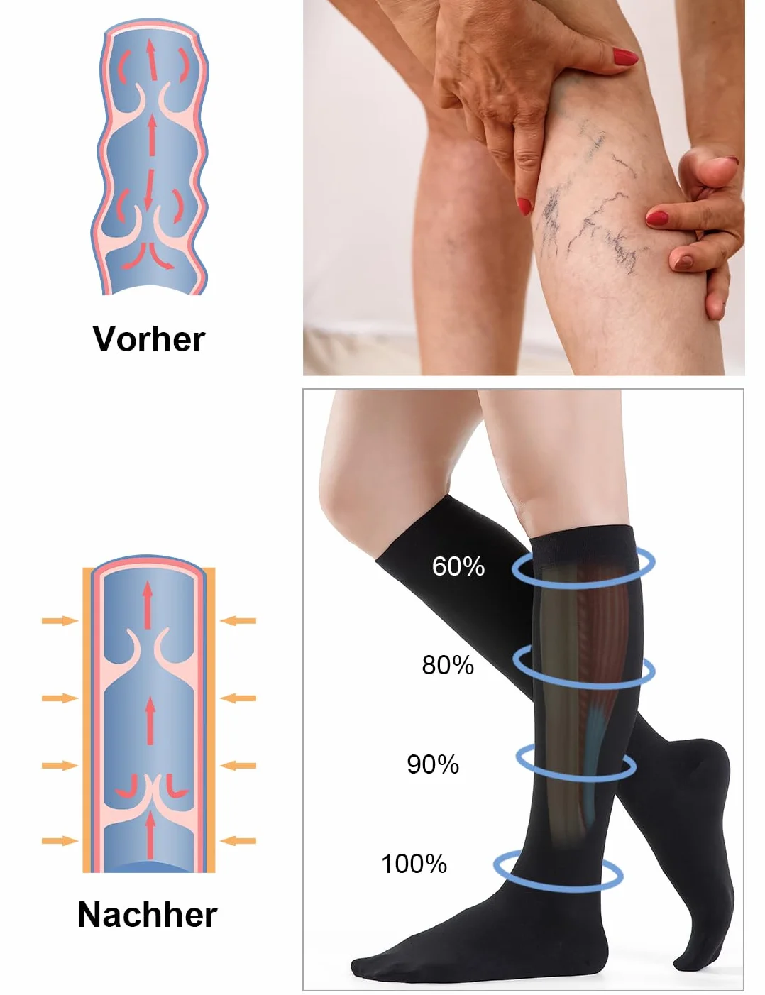 Skarpety kompresyjne 20-30 mmHg klasa 2 z zamkniętym palcem stopniowane wsparcie