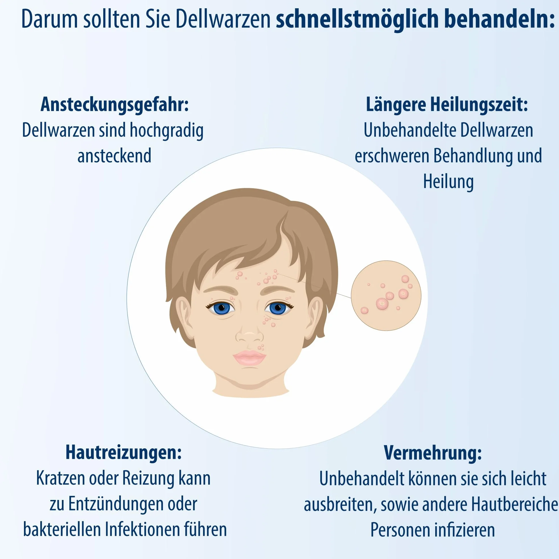 Evolsin Środek na brodawki zakaźne dla dzieci i dorosłych od 2 lat