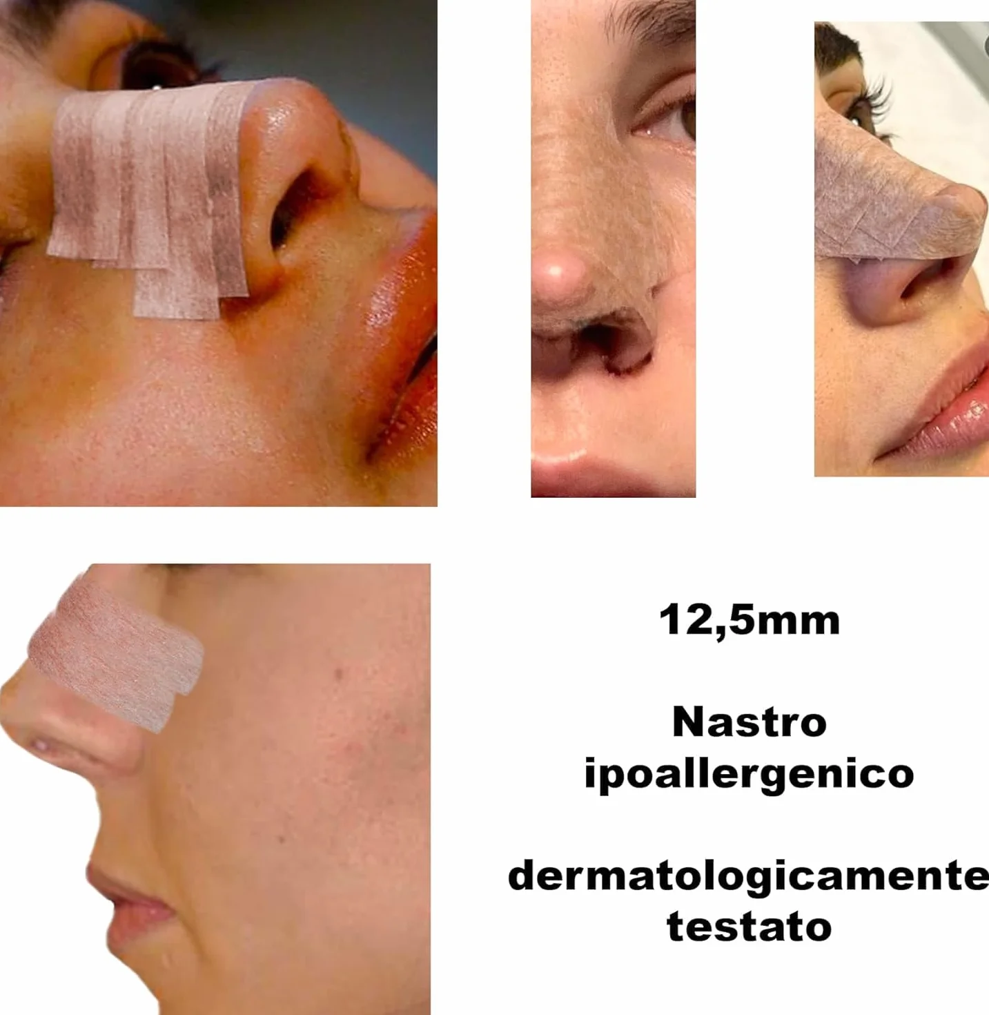 Dpm Tapes - Micropore 1533, Chirurgiczna Taśma Samoprzylepna, Certyfikat Zgodności Medycznej, Mikroporowata i Elastyczna, Plaster na Nos, Rinoplastyka - Kolor Cielisty (1.25 cm x 9 m)