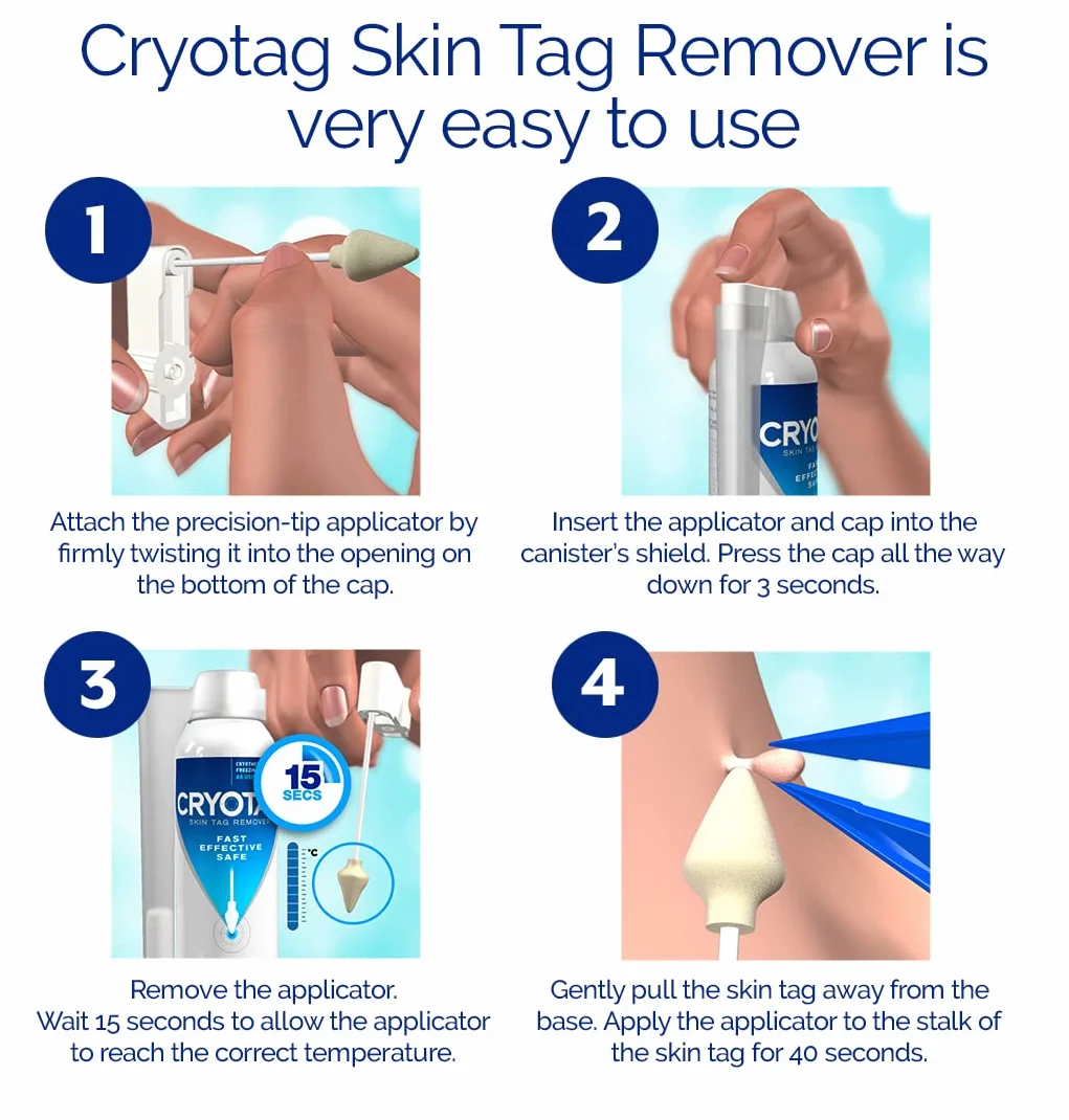 Cryotag Skin Tag Remover 12 zabiegów usuwanie brodawek