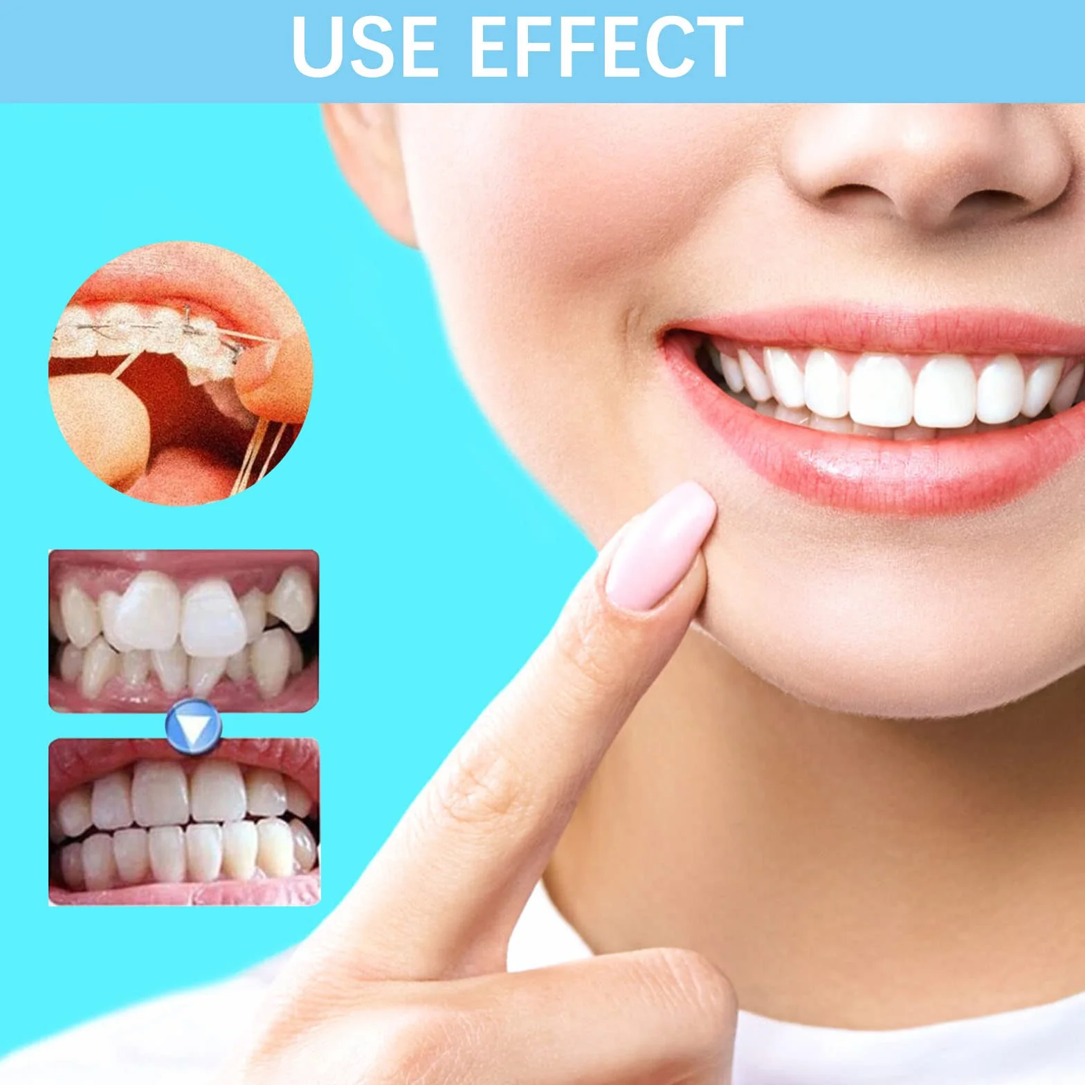 Ortodontyczne gumki, ortodontyczny luki dentystyczne, 3/16 elastycznych taśm, elastyczna opaska na zęby Oral Orthodontics 3,5 uncji, 400 szt.