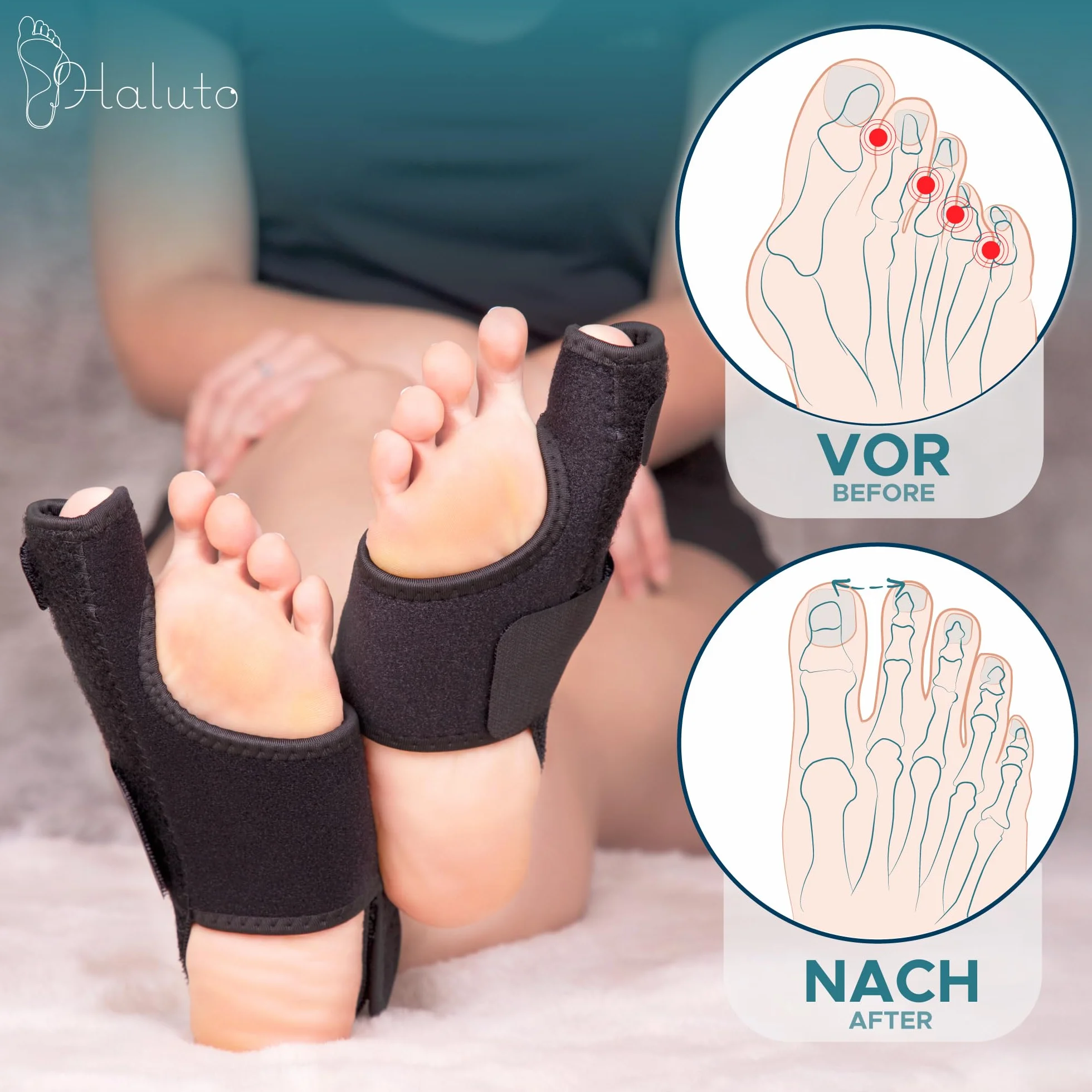 HALUTO - Szyna na haluksy - Skuteczna szyna na haluksy łagodząca ból i wspomagająca korekcję palucha koślawego - Hallux Valgus Correction Splint
