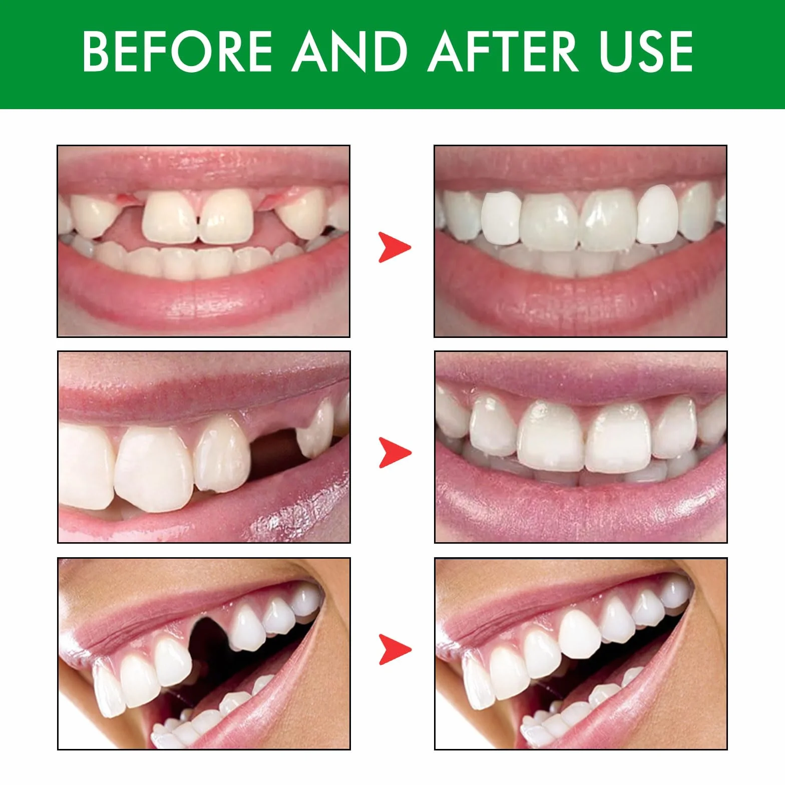 Zestaw do naprawy zębów, tymczasowe protezy zębowe, zestaw do tymczasowej naprawy zębów typu „zrób to sam”
