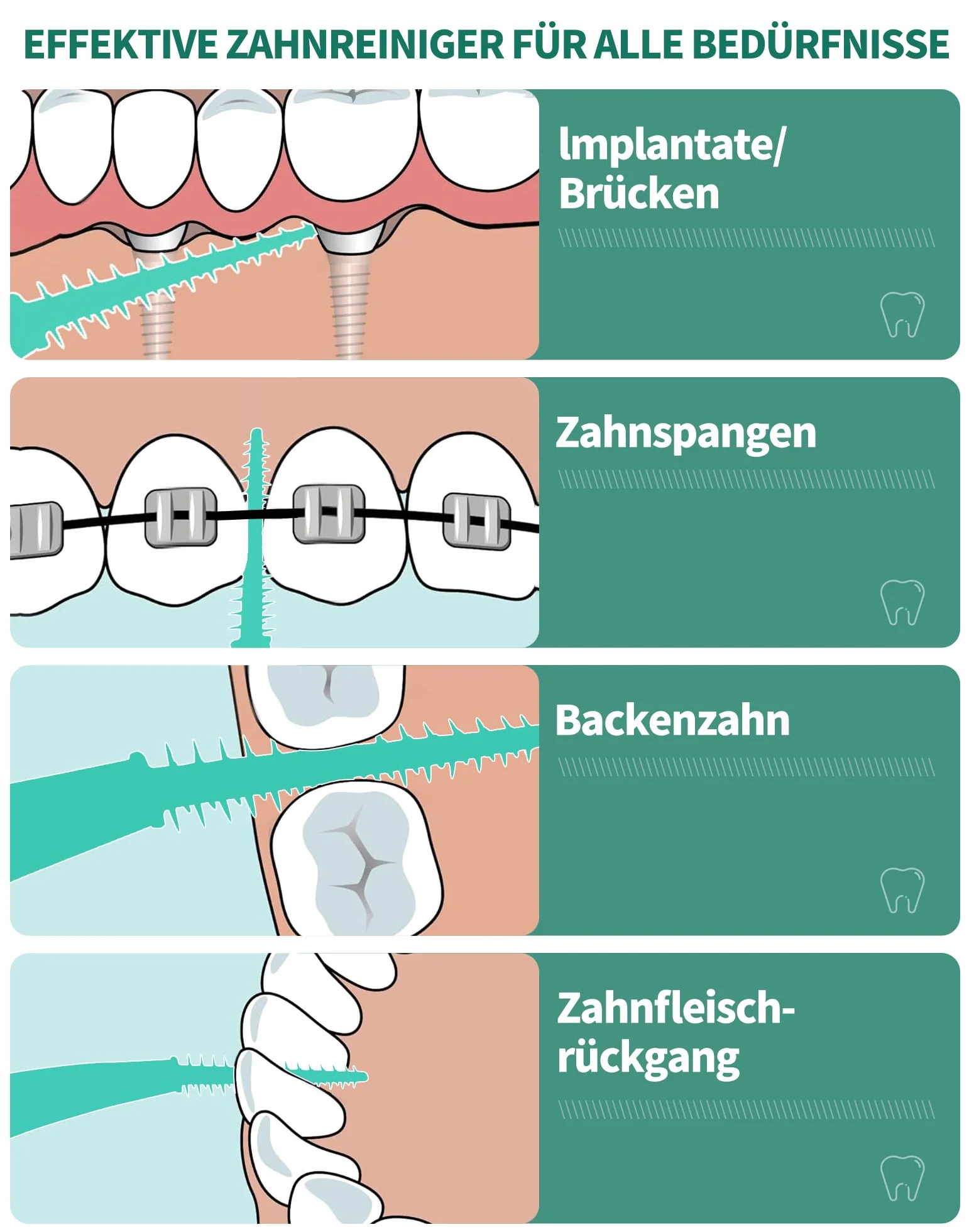 Szczoteczki międzyzębowe Angle 60 szt. Szczotki międzyzębowe Szczotki do przestrzeni międzyzębowej, zakrzywiony kształt, gumowe patyczki do zębów zapewniają łatwy dostęp do trudno dostępnych