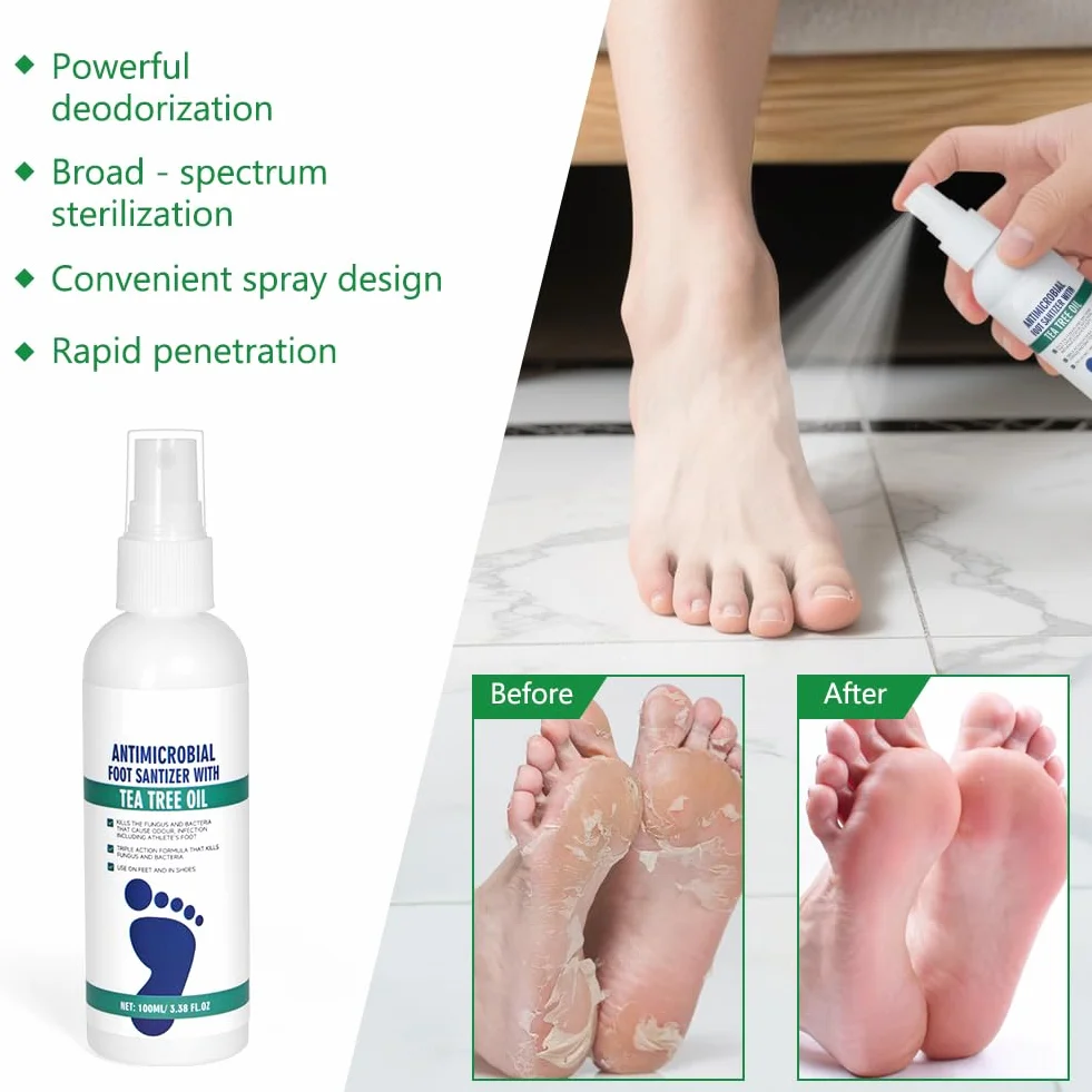Spray przeciw grzybicy stóp AOOWU 100 ml naturalna formuła