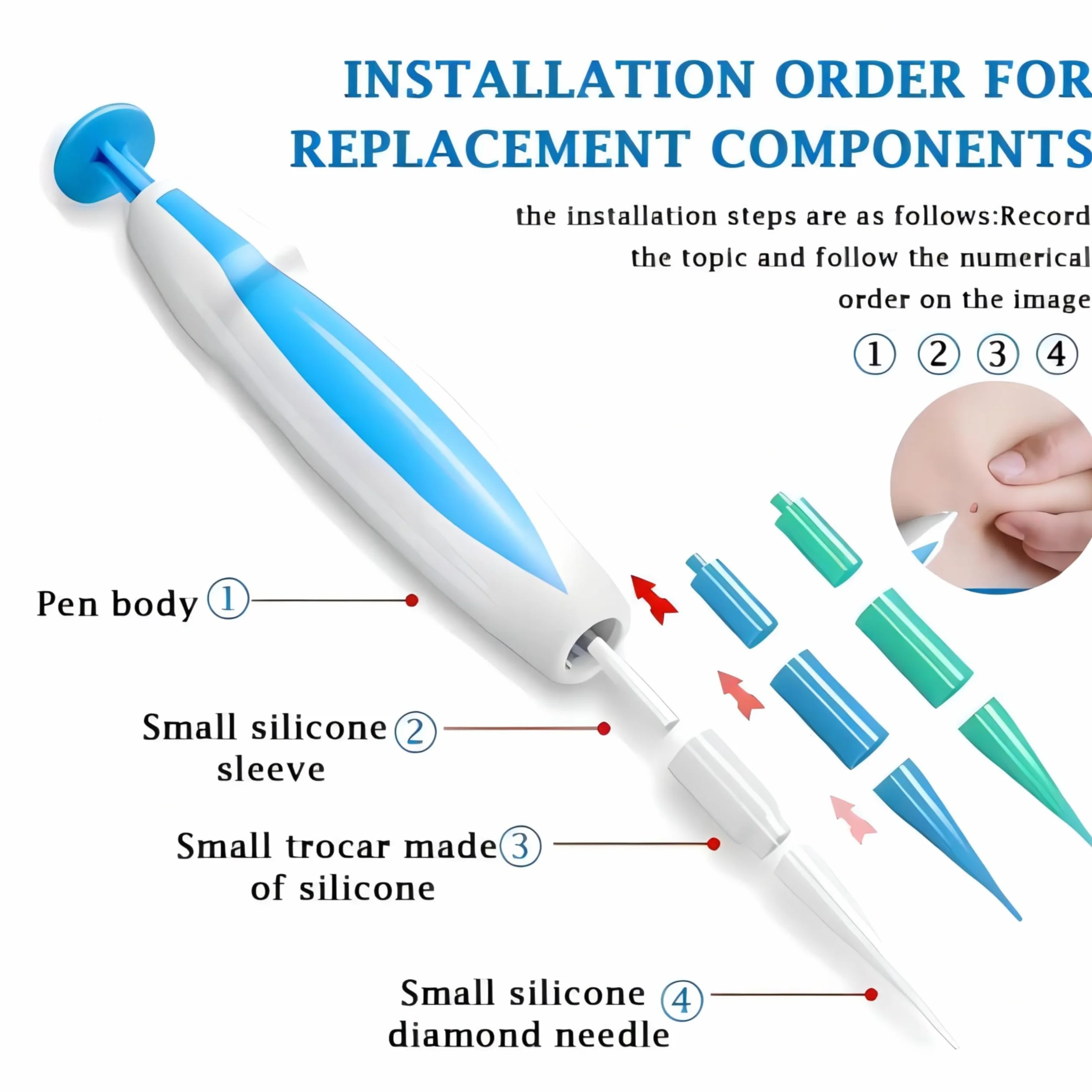 Auto Skin Tag Remover zestaw do usuwania brodawek 3 w 1 (1-8 mm)